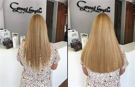 Hajhosszabbítás Great Lengths működési folyamat