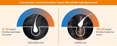 Diagram: Lakóingatlan fogalma és a hozzá kapcsolódó helyiségek áfa-kezelése